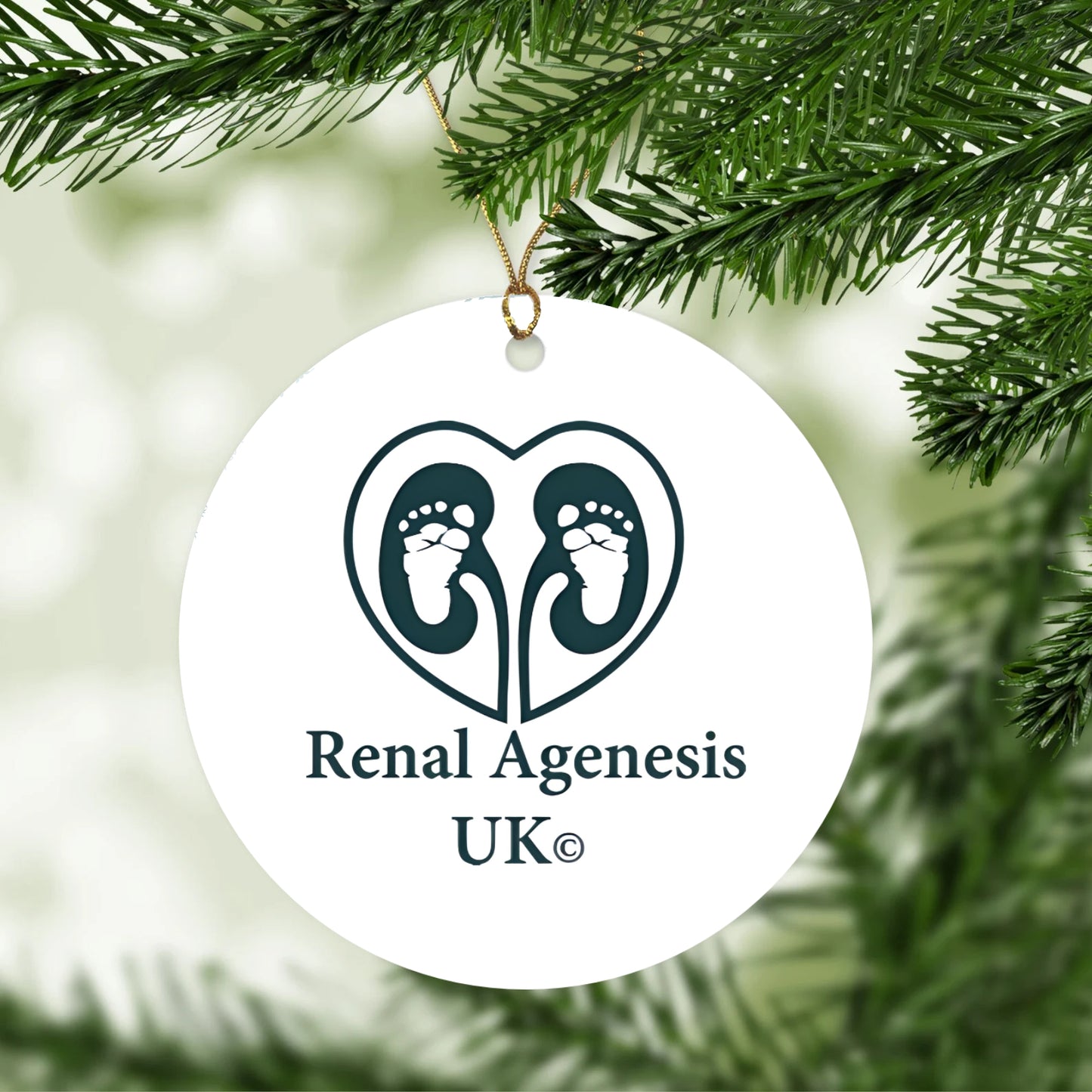 White Feather Christmas Tree Decoration- Renal Agenesis Charity